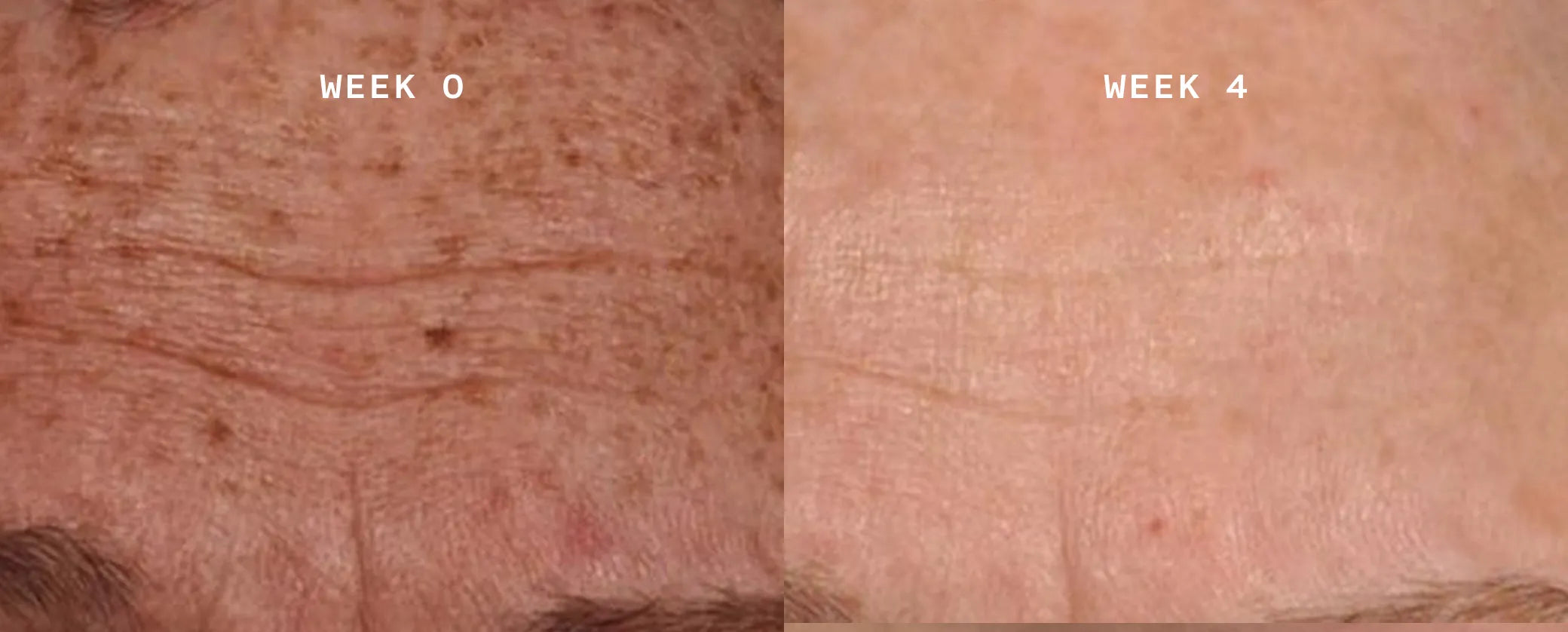 Ageless Lens Ergebnis 2